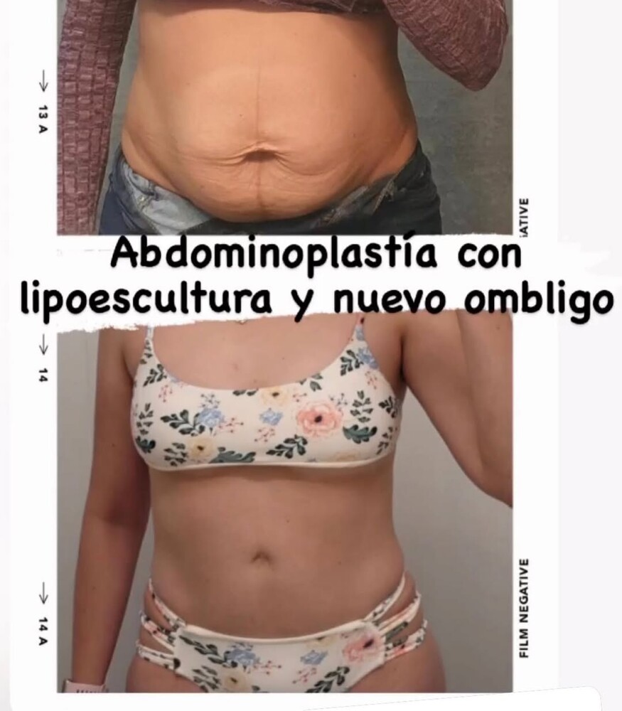 Before and After Result